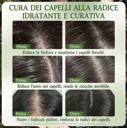 Shampoo PureScalp anticaduta - 12 piante naturali